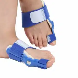 Paskyee Lot de 2 correcteurs d'oignons, orthèses orthopédiques pour homme et femme, attelle réglable avec séparateur d'orteils pour soulager l'oignon, bleu