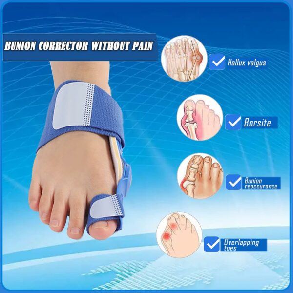Paskyee Lot de 2 correcteurs d'oignons, orthèses orthopédiques pour homme et femme, attelle réglable avec séparateur d'orteils pour soulager l'oignon, bleu – Image 6