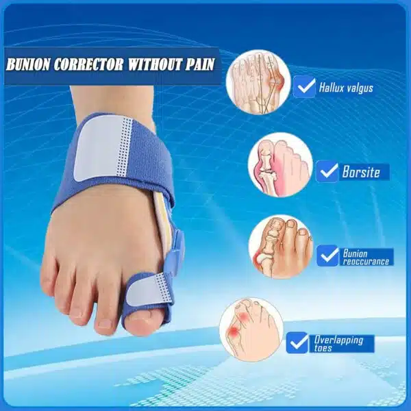 Paskyee Lot de 2 correcteurs d'oignons, orthèses orthopédiques pour homme et femme, attelle réglable avec séparateur d'orteils pour soulager l'oignon, bleu – Image 6