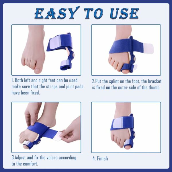 Paskyee Lot de 2 correcteurs d'oignons, orthèses orthopédiques pour homme et femme, attelle réglable avec séparateur d'orteils pour soulager l'oignon, bleu – Image 4